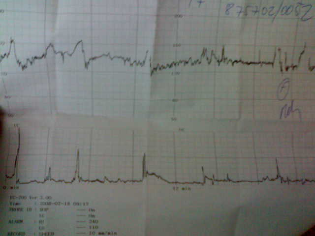 Monitor 39+1tt