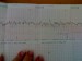 Monitor 35+4tt