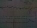 Monitor 36+1tt