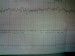 Monitor 38+1tt - odpolední