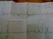 Monitor 40+1tt